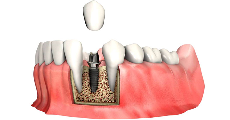 BioDent&nbsp;Dental Clinic in Prague